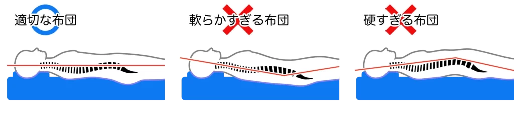 マットレスの硬さによる背骨の状態の違い（適切・柔らかすぎる・硬すぎる）