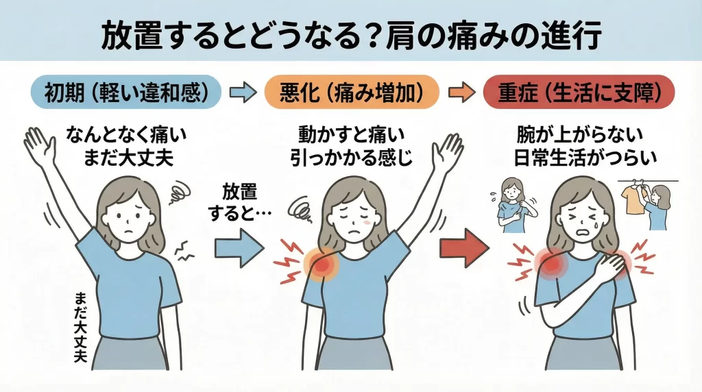 腕を上げると肩が痛い症状が初期から重症へ進行する流れを示した図（放置による悪化）