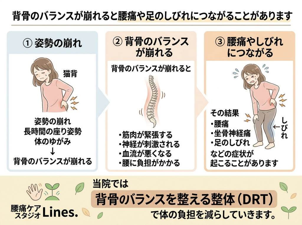 姿勢の崩れによって背骨のバランスが乱れ、腰痛や坐骨神経痛、足のしびれにつながる仕組みを説明した図